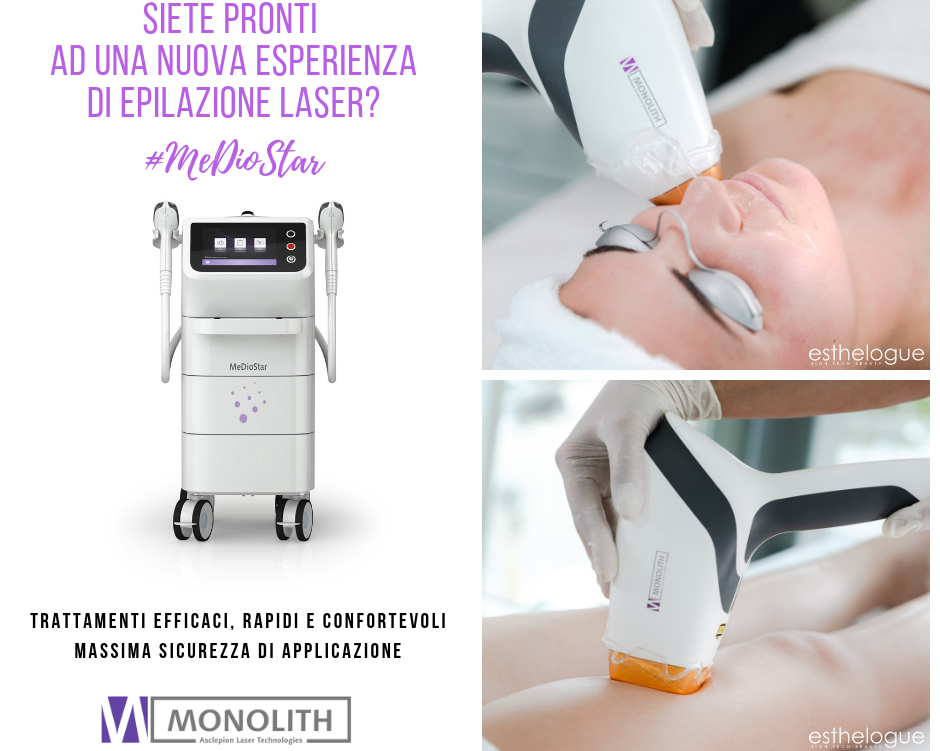 epilazione laser caserta