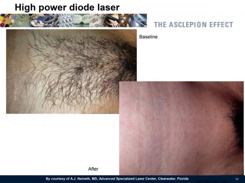 Foto PrimaDopo MeDioStar-10 - Copia