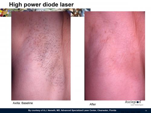 Foto PrimaDopo MeDioStar-14 - Copia