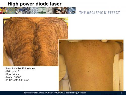 Foto PrimaDopo MeDioStar-3 - Copia