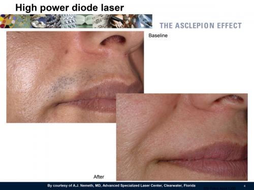 Foto PrimaDopo MeDioStar-4